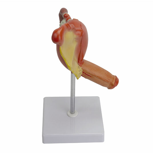 Mô hình Giải phẫu Cơ quan Sinh dục Nữ có Bệnh lý, 2 phần [Mã SP: MG29947]