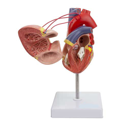 Mô hình tim cổ điển với phẫu thuật bắc cầu động mạch vành [Mã sản phẩm: MG22275]
