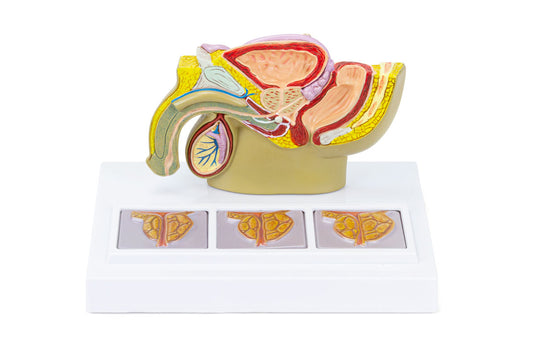 Mô hình Khung chậu nam có tuyến tiền liệt, kích thước nửa mẫu [Mã sản phẩm: MG34916]